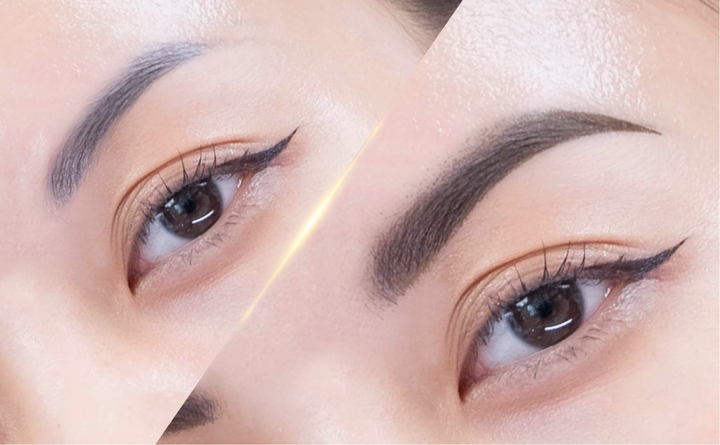 ផ្លុំ​សាក់​ផ្នែក​សោភ័ណភាព